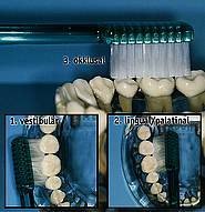 Systematik beim Zähneputzen
