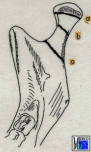 Frakturen des Gelenkfortsatzes:a: Kondylusfraktur,b: Kollumfraktur,c: Gelenkfortsatzbasisfraktur