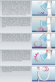 Verschiedene Zahnputzmethoden