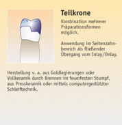 Teilkrone