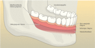 Aufbau von Gingiva und Mundschleimhaut (Mukosa)